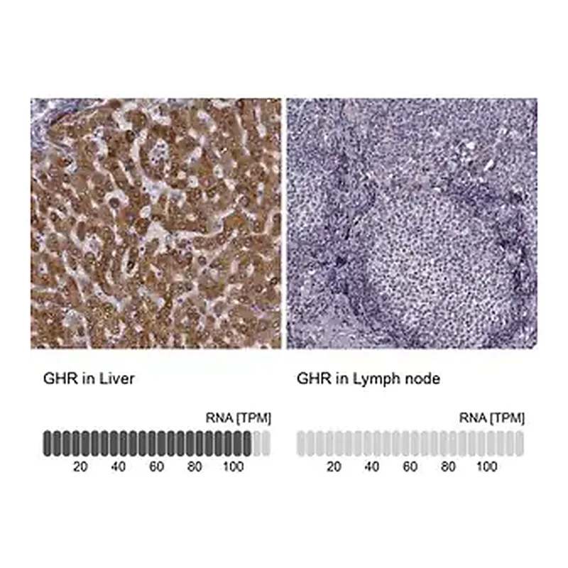 Merck Anti-GHR antibody produced in rabbit
