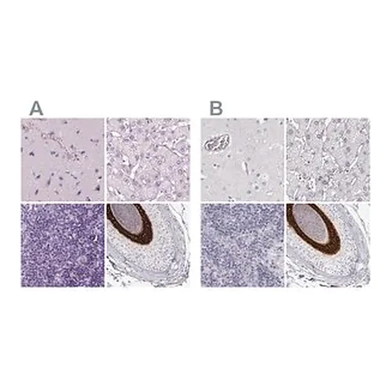 Merck Anti-KRT25 antibody produced in rabbit