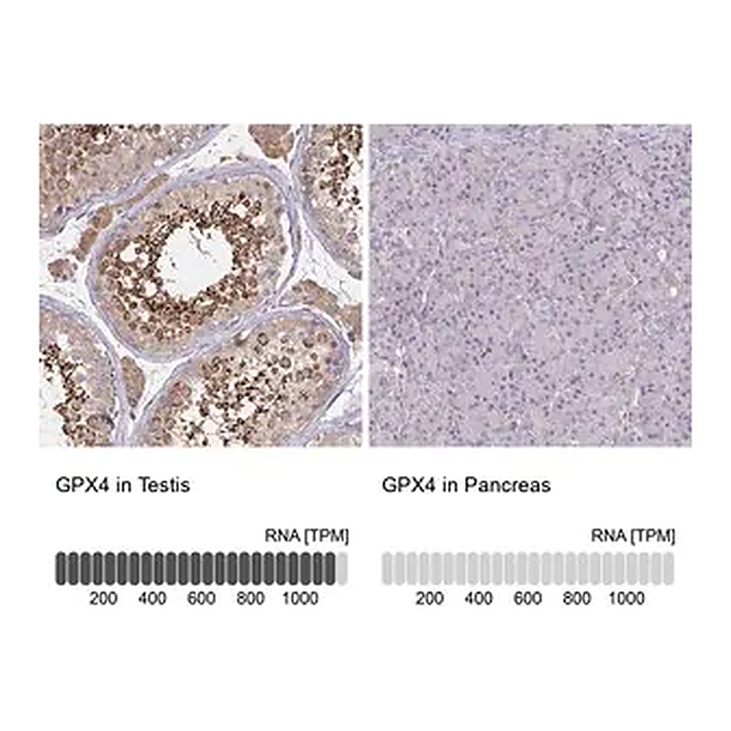 Merck Anti-GPX4 antibody produced in rabbit