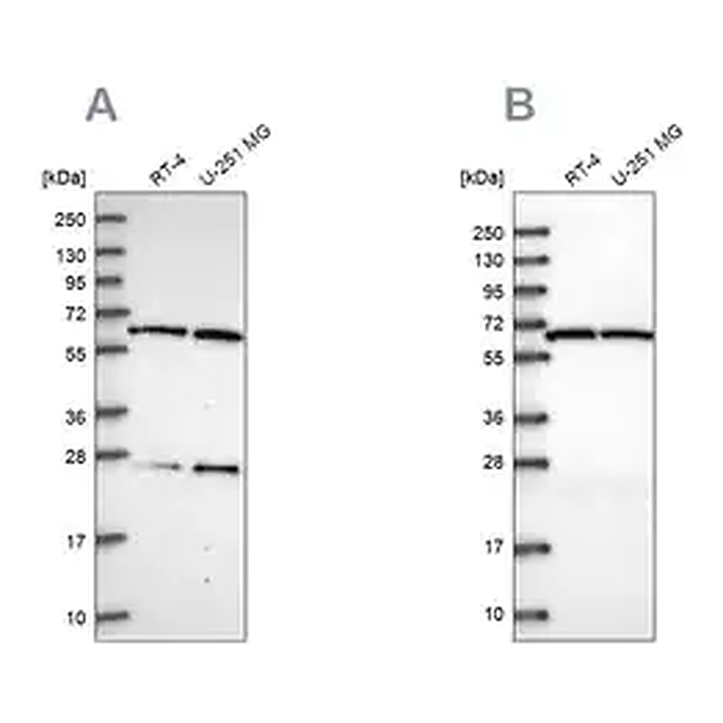 Merck Anti-ACAD9 antibody produced in rabbit