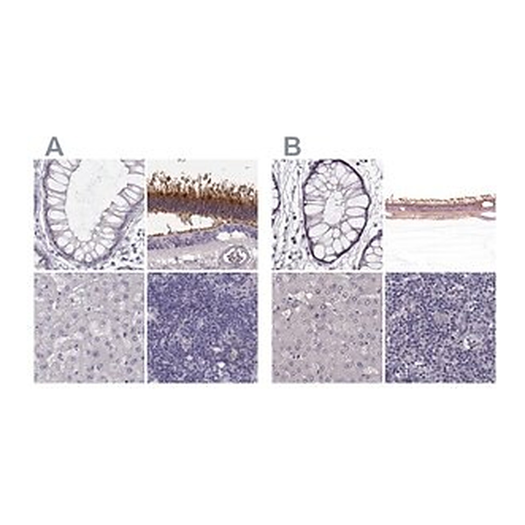 Merck Anti-GRK1 antibody produced in rabbit