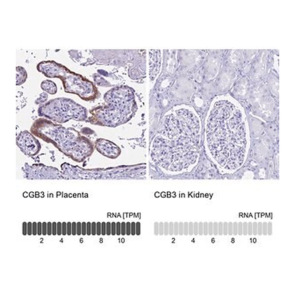 Merck Anti-CGB3 antibody produced in rabbit