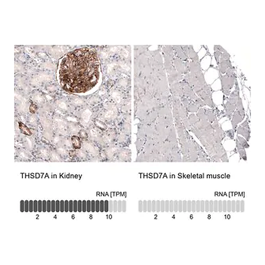Merck Monoclonal Anti-THSD7A antibody produced in mouse
