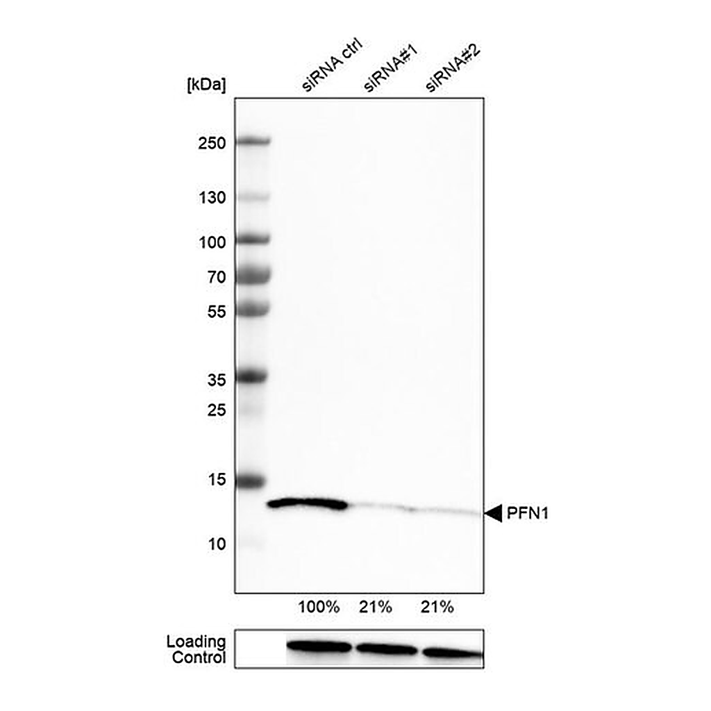 Merck Monoclonal Anti-PFN1 antibody produced in mouse