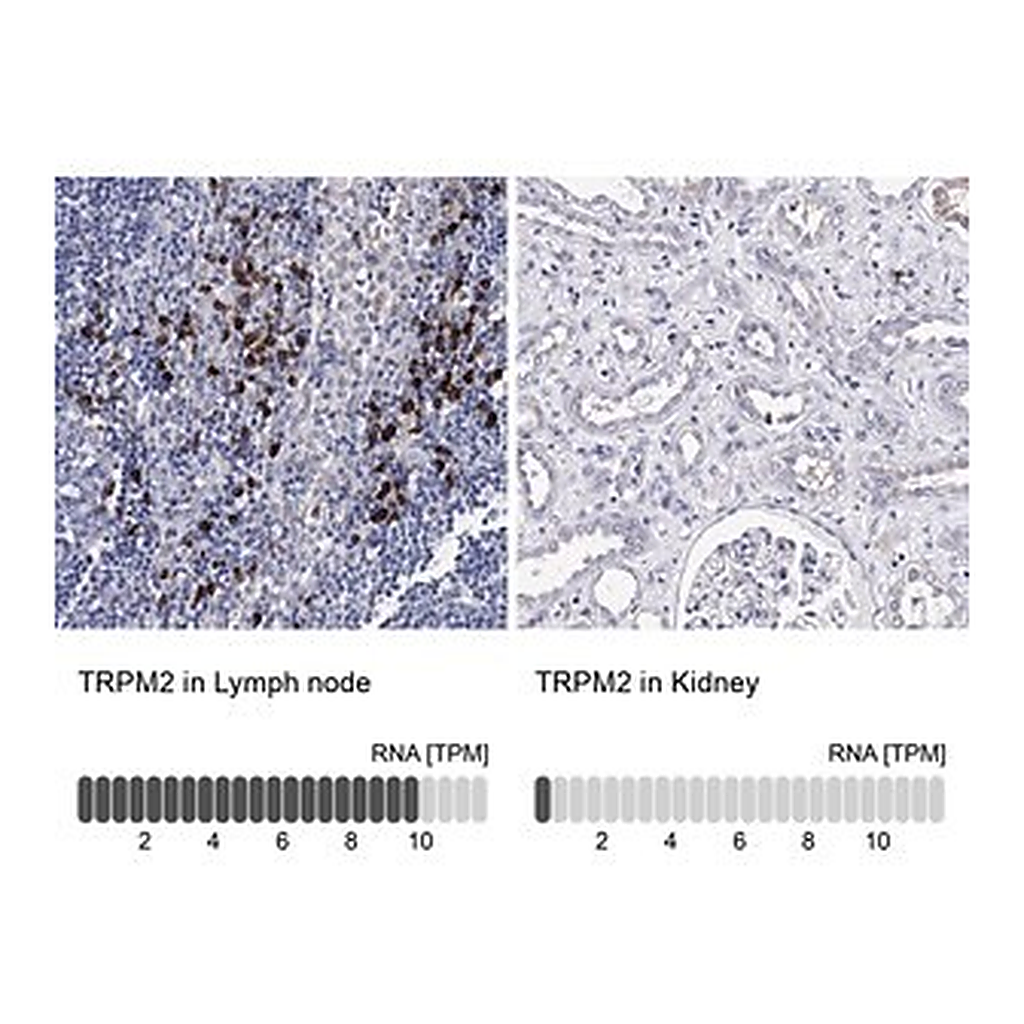 Merck Anti-TRPM2 antibody produced in rabbit