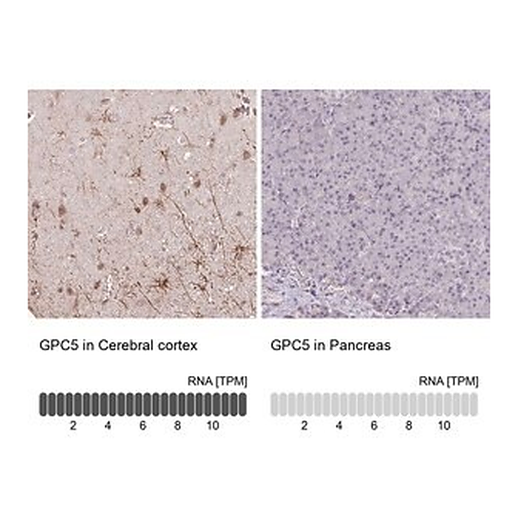 Merck Anti-GPC5 antibody produced in rabbit