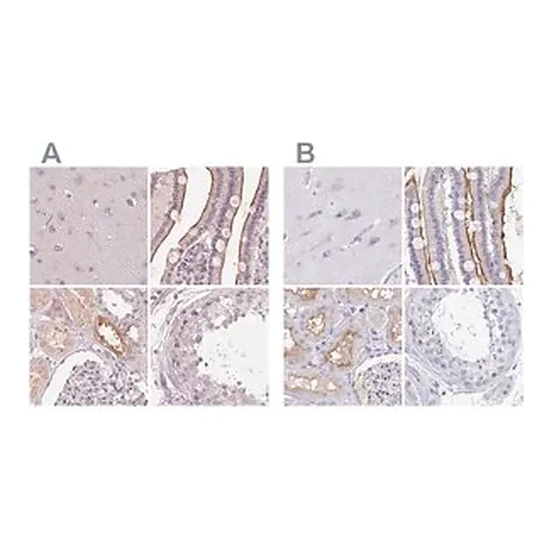 Merck Anti-TREH antibody produced in rabbit