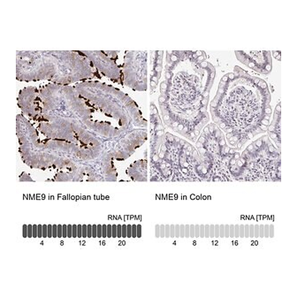 Merck Anti-NME9 antibody produced in rabbit