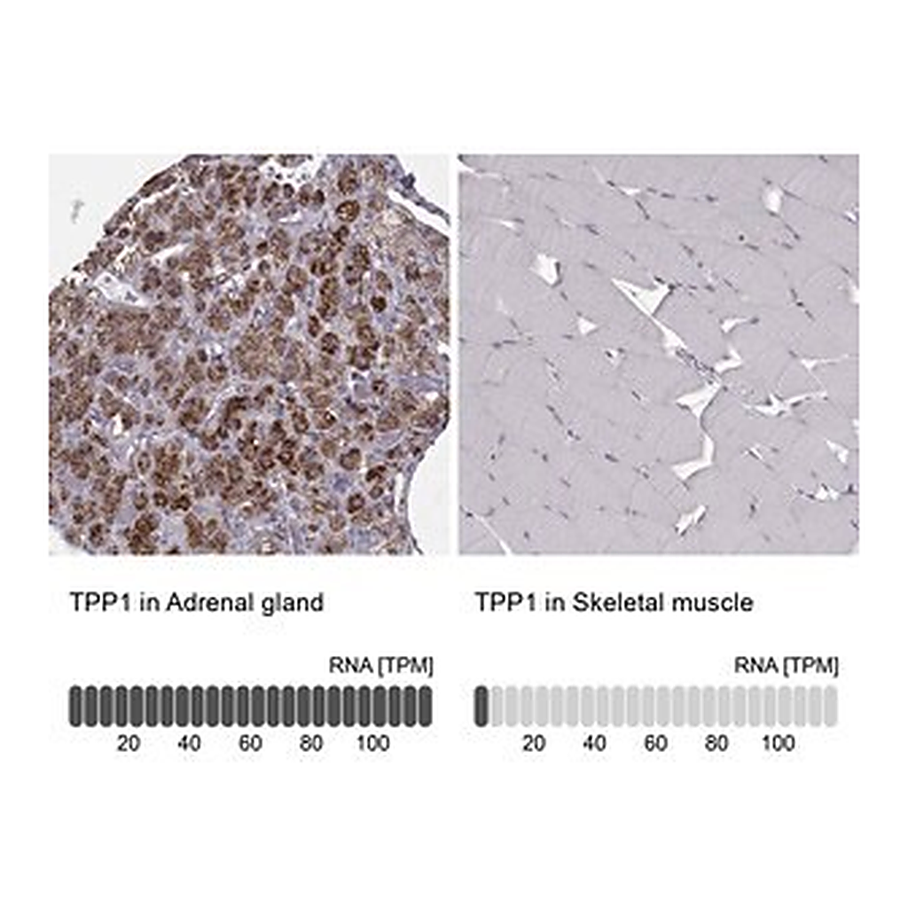 Merck Anti-TPP1 antibody produced in rabbit