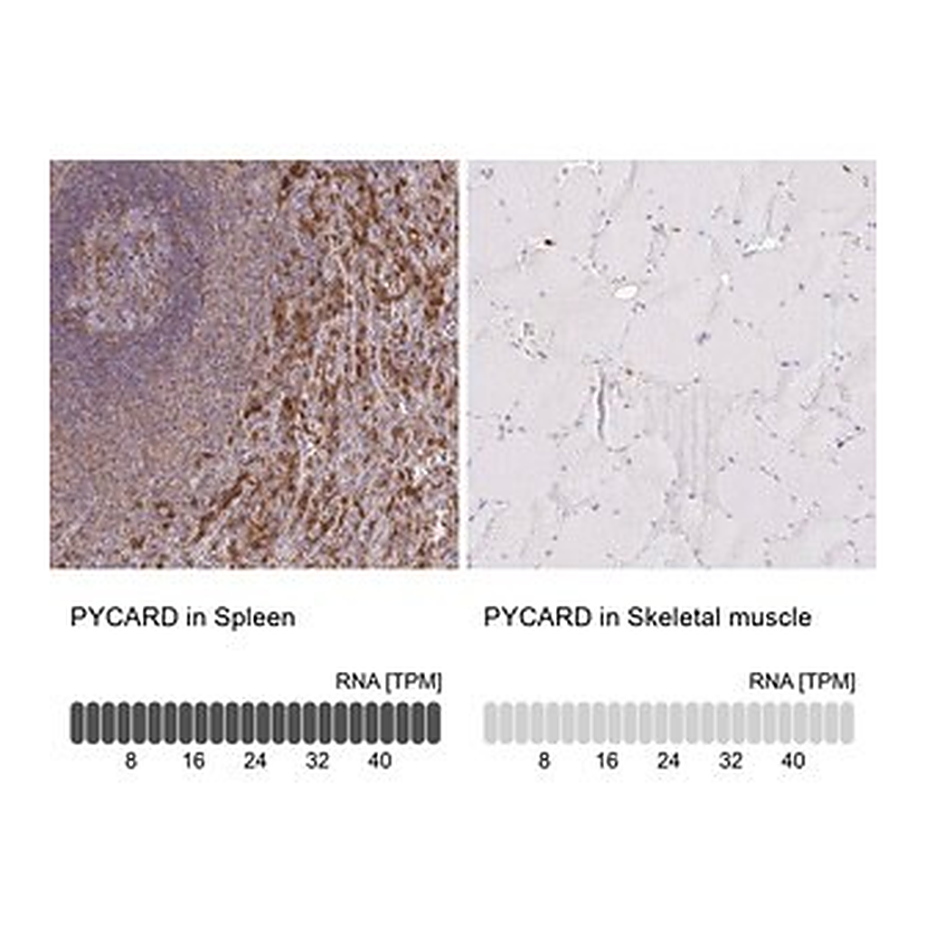 Merck Anti-PYCARD antibody produced in rabbit
