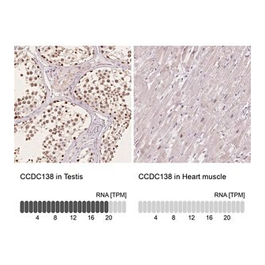 Merck Anti-CCDC138 antibody produced in rabbit