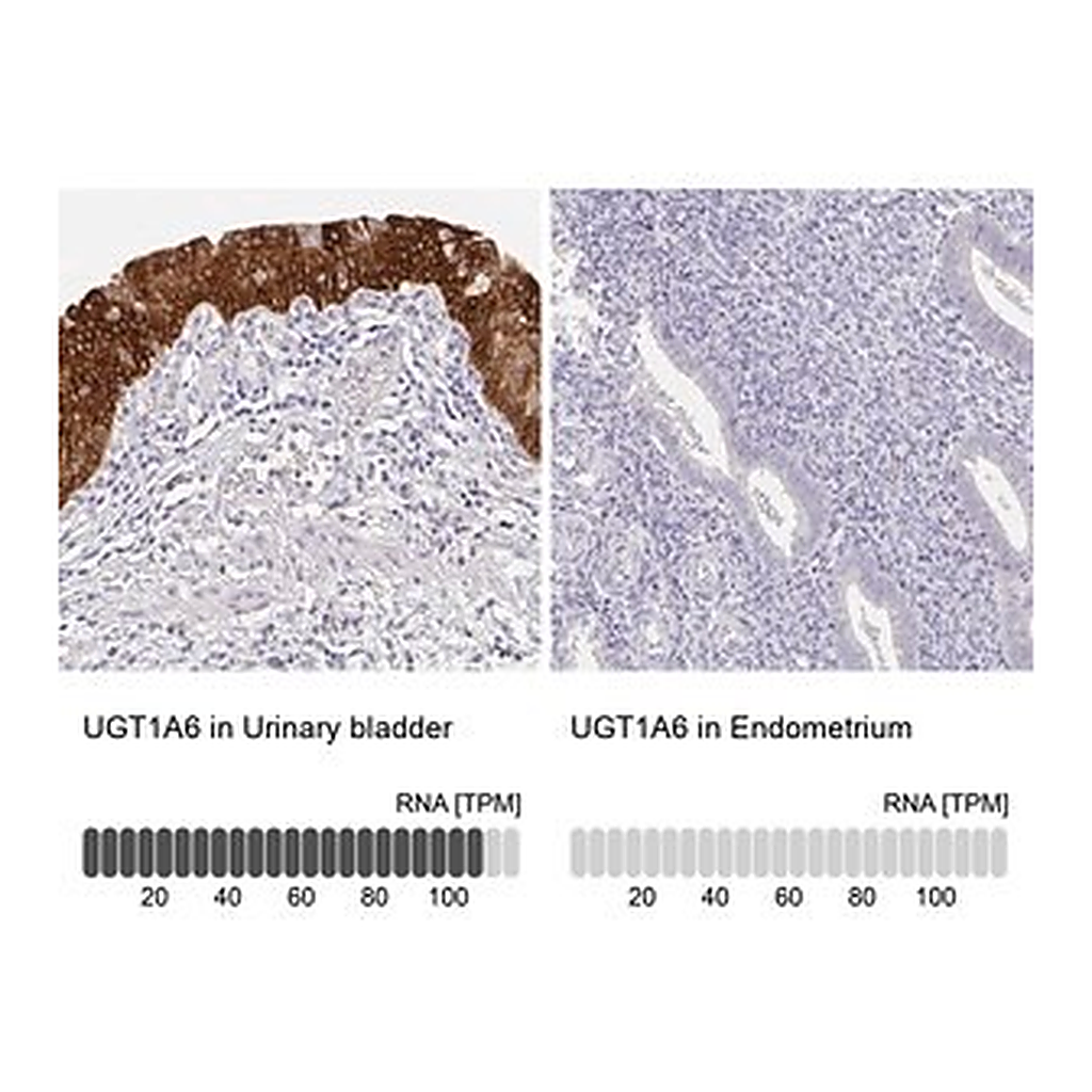 Merck Anti-UGT1A6 antibody produced in rabbit