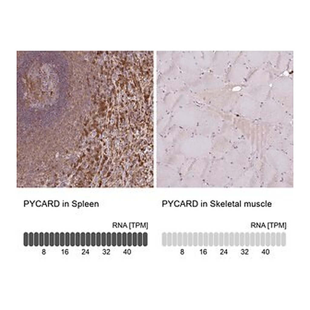 Merck Anti-PYCARD antibody produced in rabbit