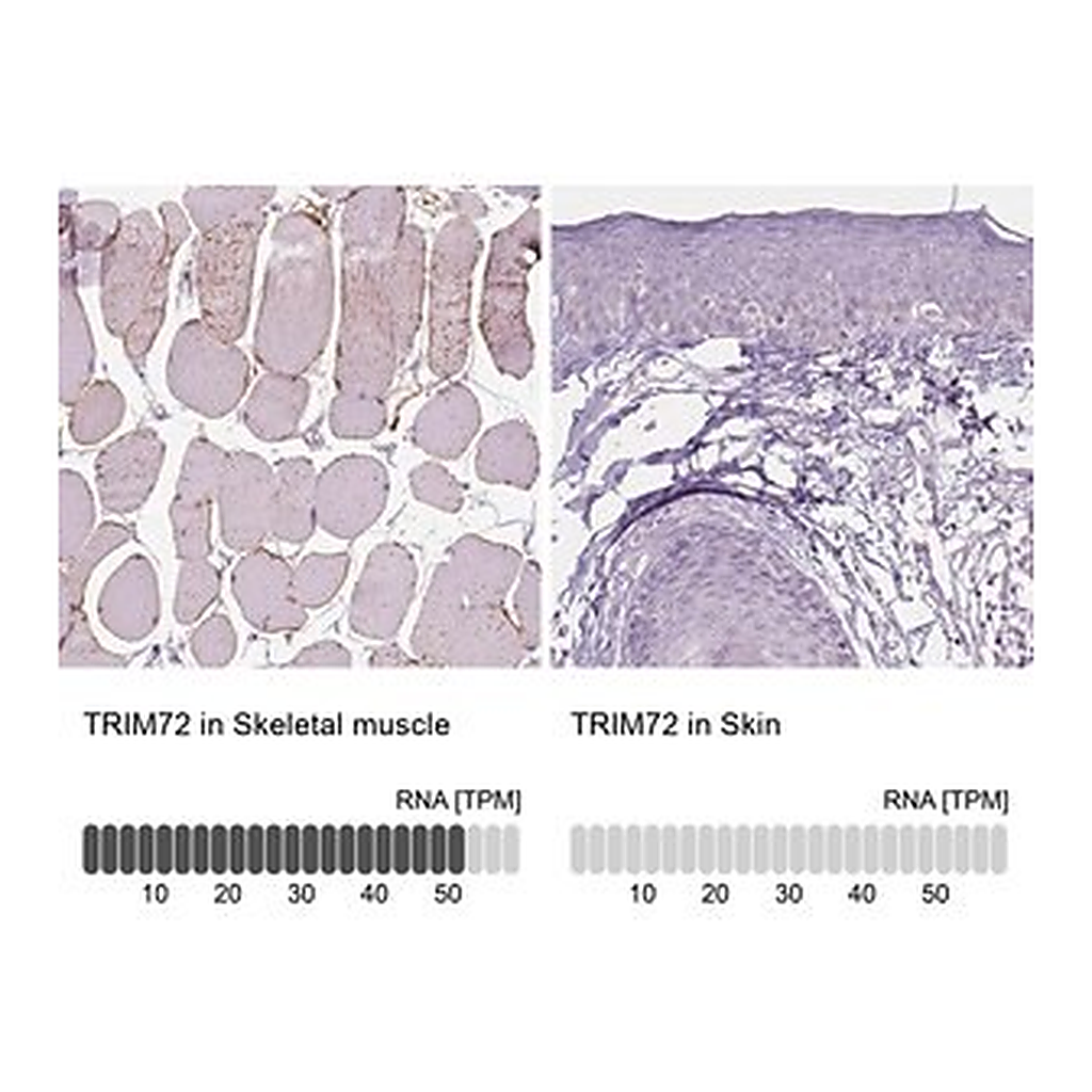 Merck Anti-TRIM72 antibody produced in rabbit
