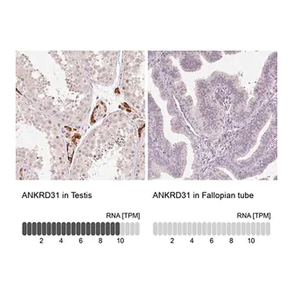 Merck Anti-ANKRD31 antibody produced in rabbit