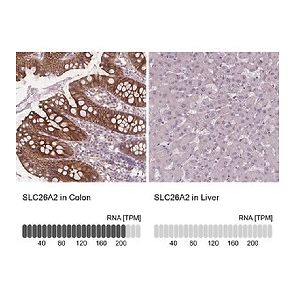 Merck Anti-SLC26A2 antibody produced in rabbit
