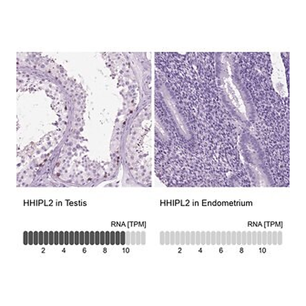 Merck Anti-HHIPL2 antibody produced in rabbit