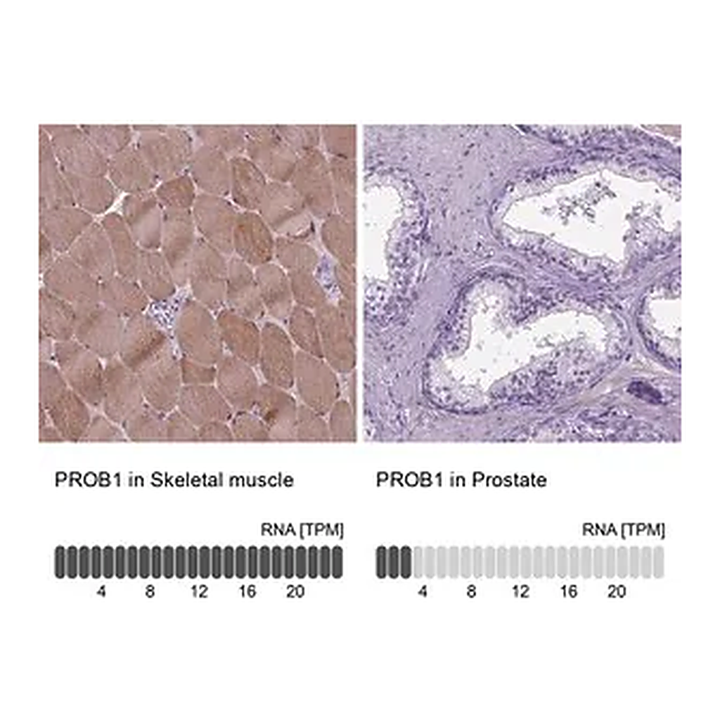 Merck Anti-PROB1 antibody produced in rabbit