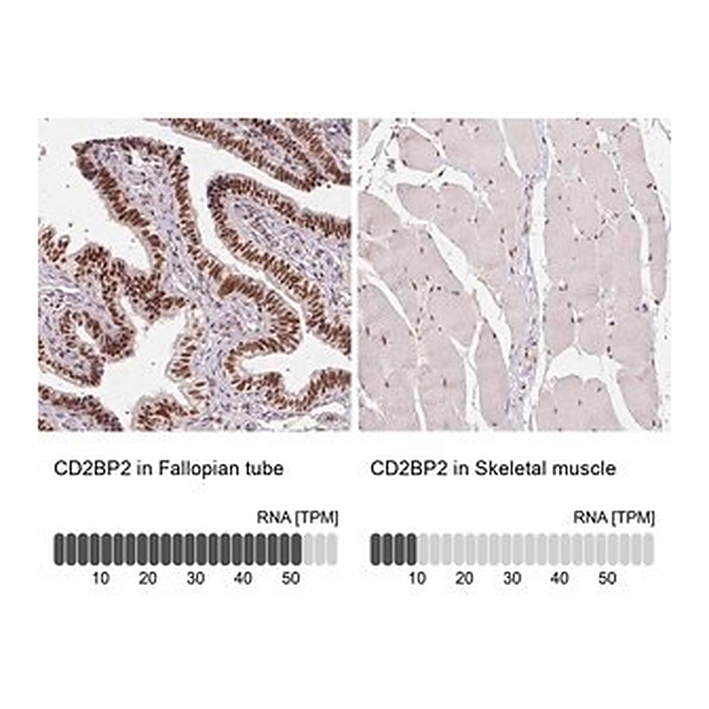 Merck Anti-CD2BP2 antibody produced in rabbit