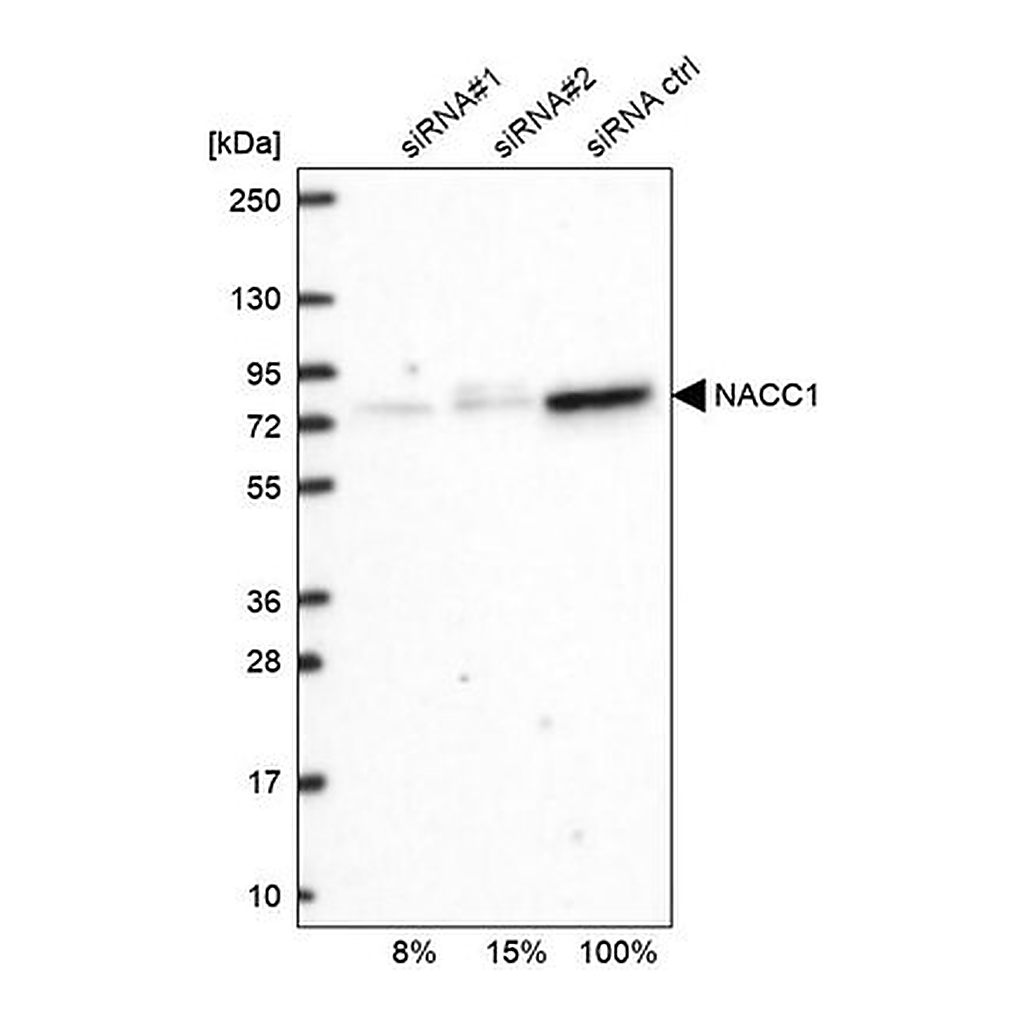 Merck Anti-NACC1 antibody produced in rabbit