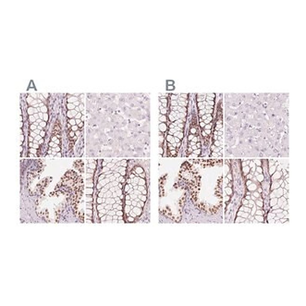 Merck Anti-HOXB13 antibody produced in rabbit