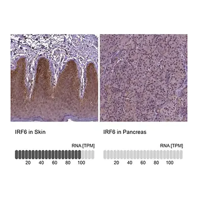 Merck Anti-IRF6 antibody produced in rabbit