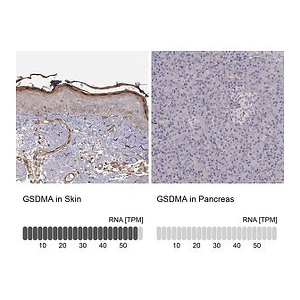 Merck Anti-GSDMA antibody produced in rabbit