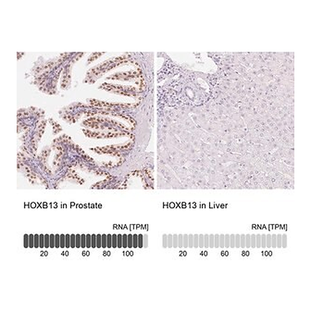 Merck Anti-HOXB13 antibody produced in rabbit