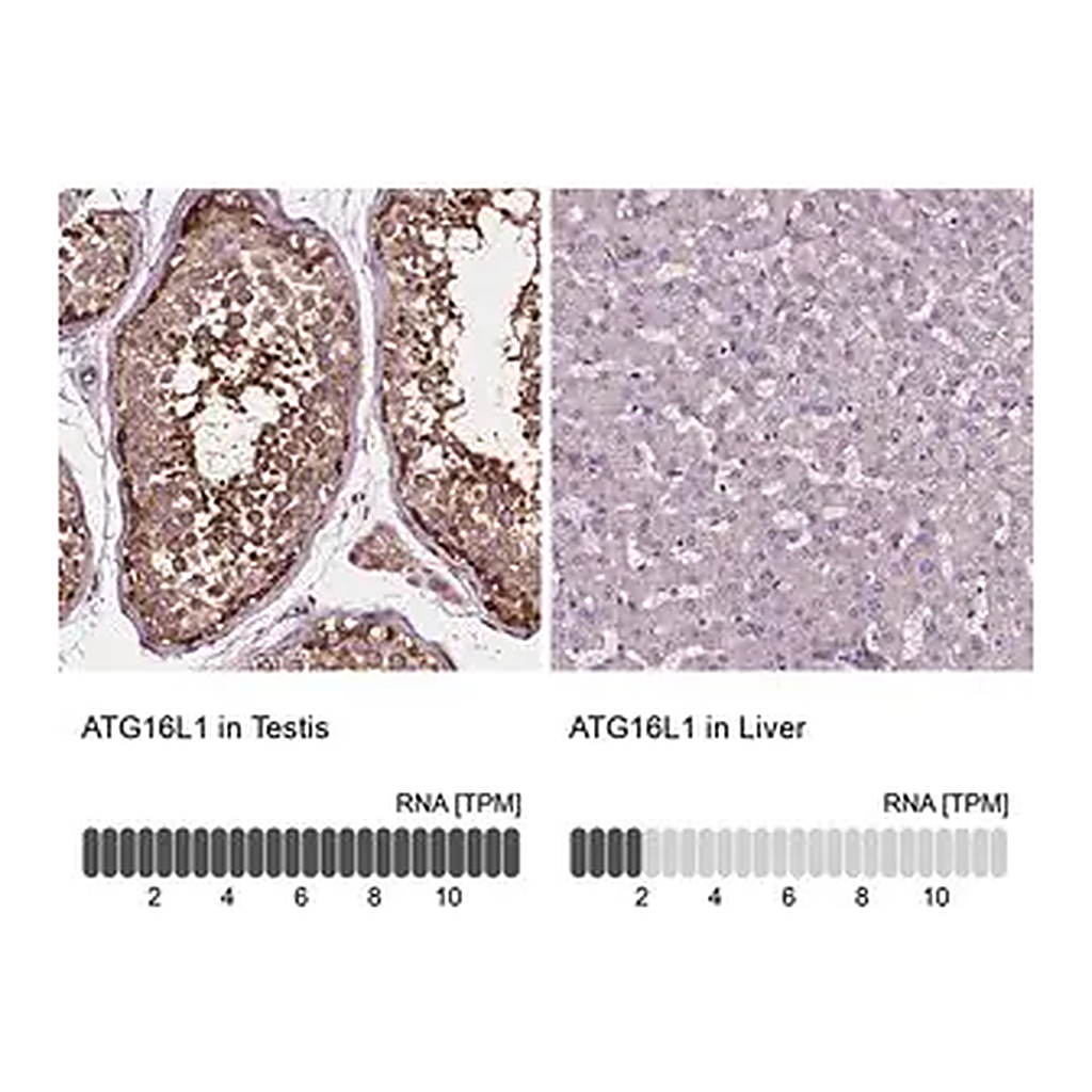 Merck Anti-ATG16L1 antibody produced in rabbit