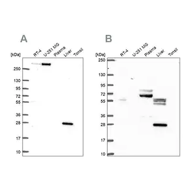 Merck Anti-QDPR antibody produced in rabbit