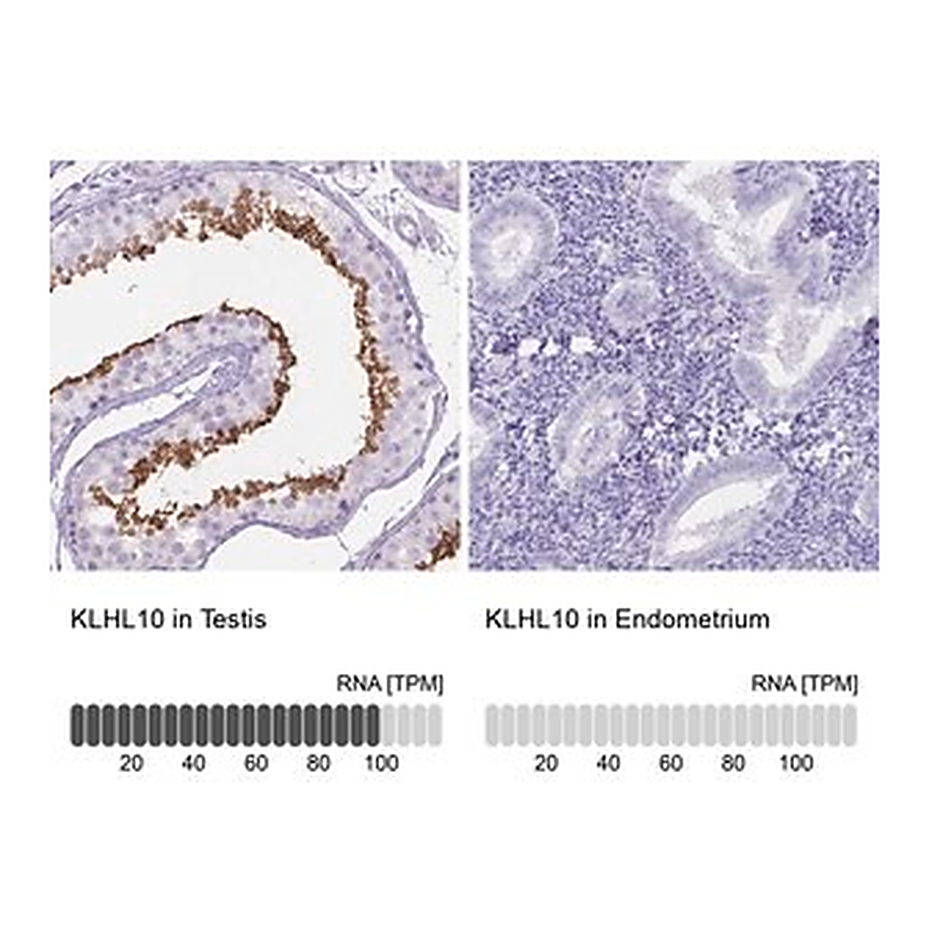 Merck Anti-KLHL10 antibody produced in rabbit