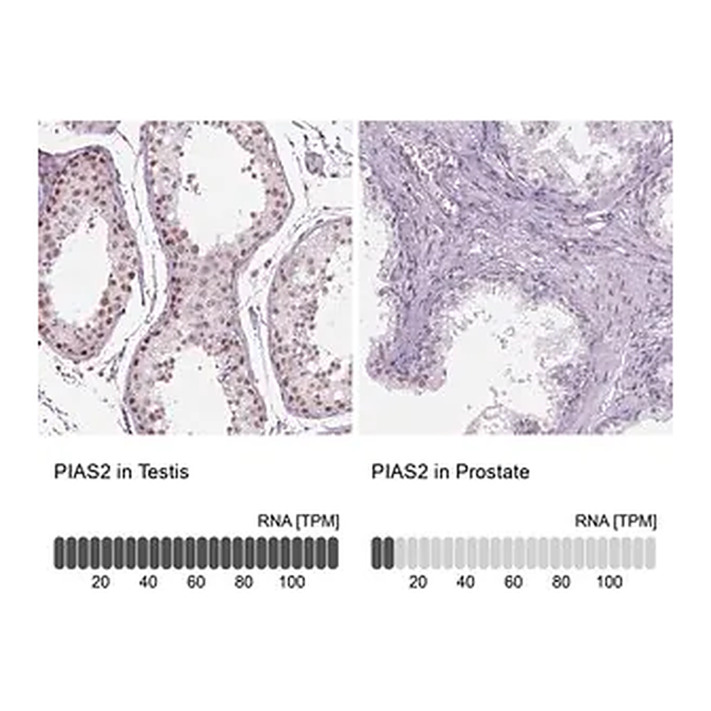 Merck Anti-PIAS2 antibody produced in rabbit