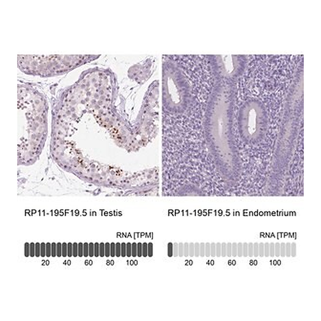 Merck Anti-RP11-195F19.5 antibody produced in rabbit