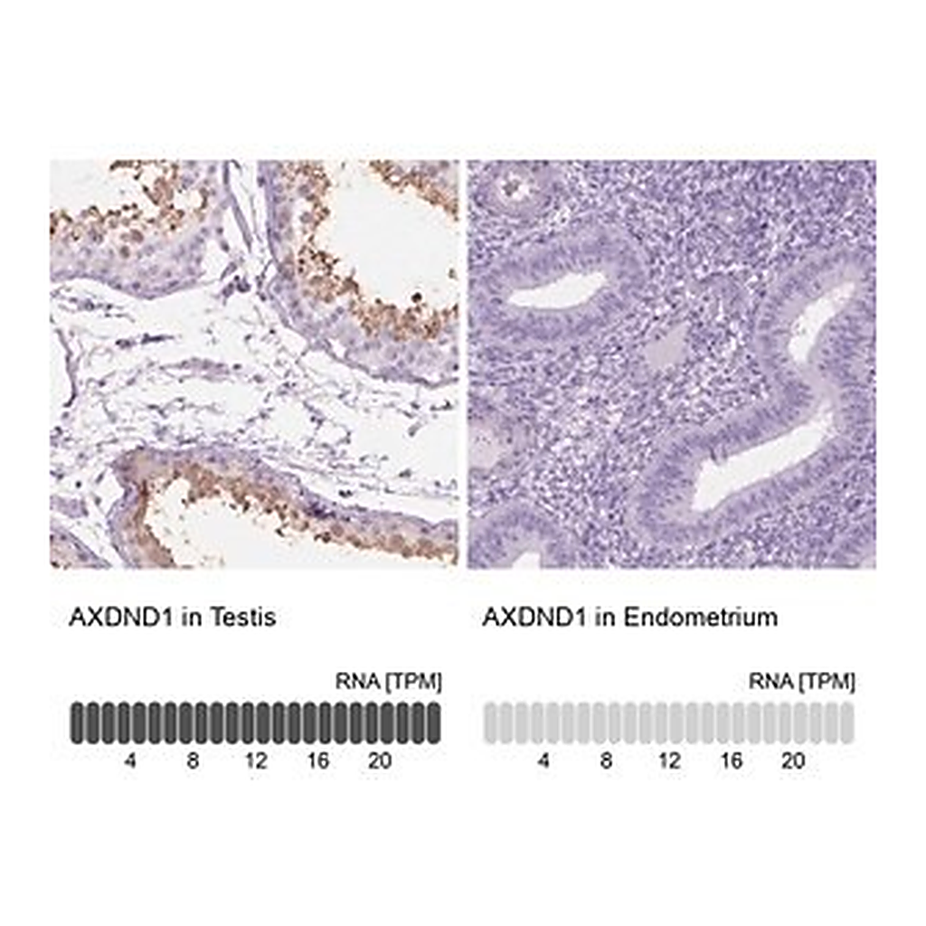 Merck Anti-AXDND1 antibody produced in rabbit