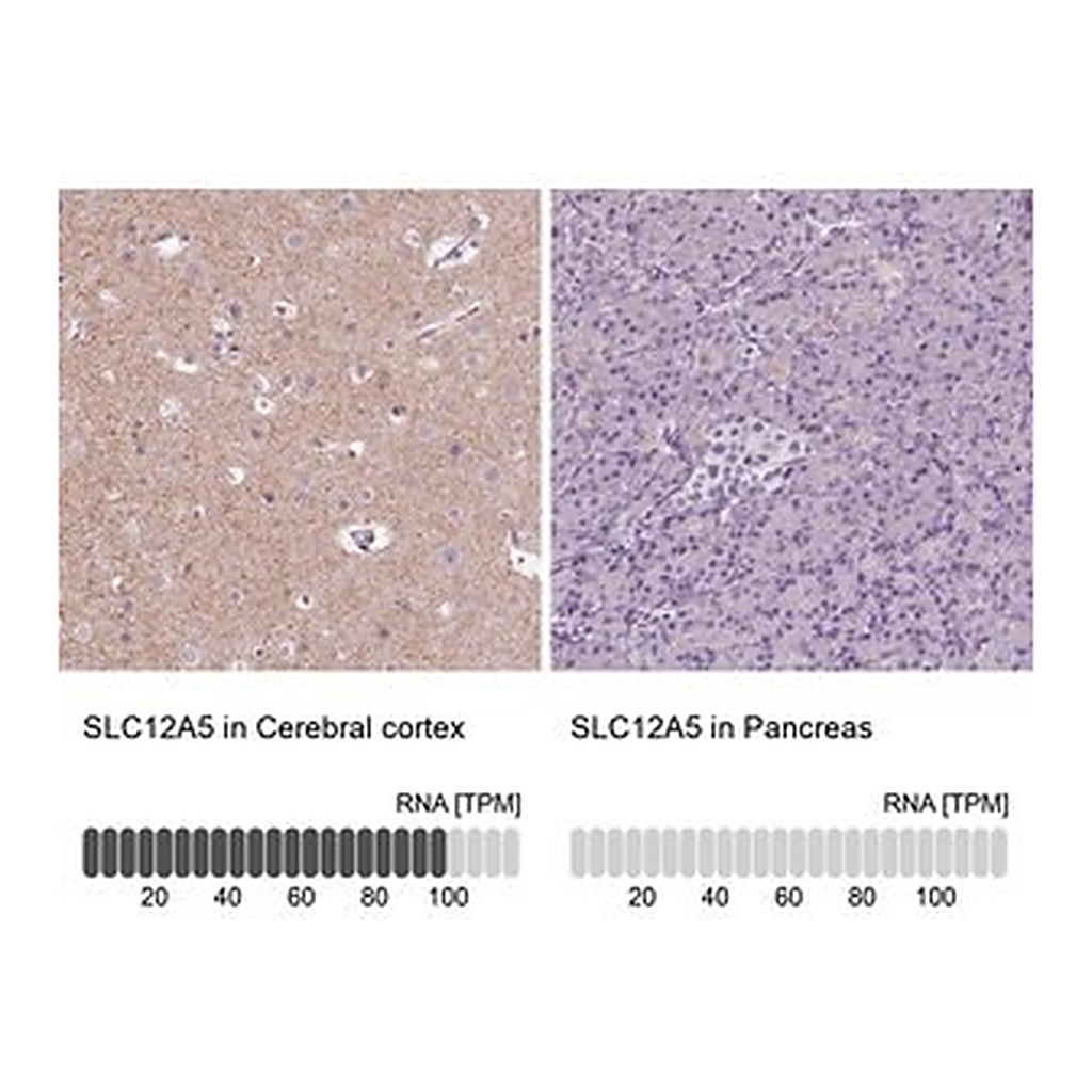 Merck Anti-SLC12A5 antibody produced in rabbit