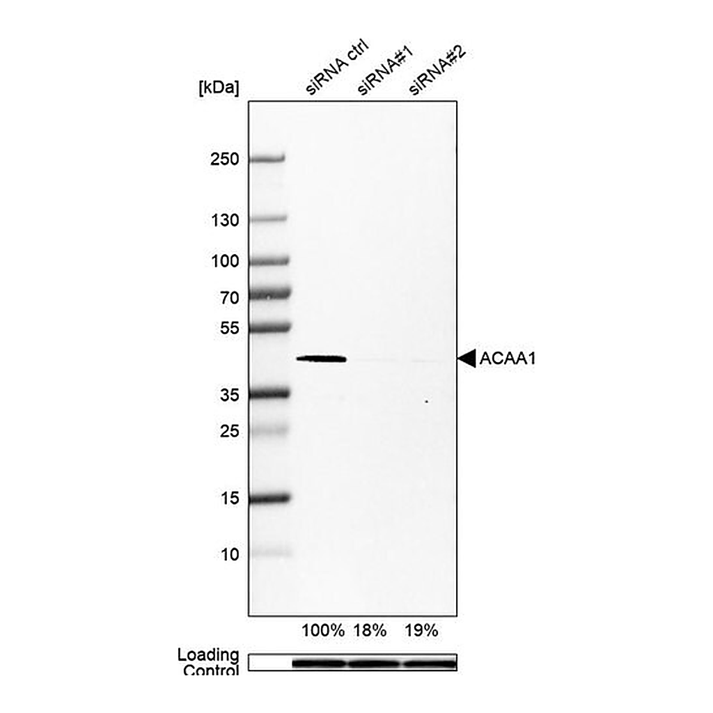 Merck Monoclonal Anti-ACAA1 antibody produced in mouse