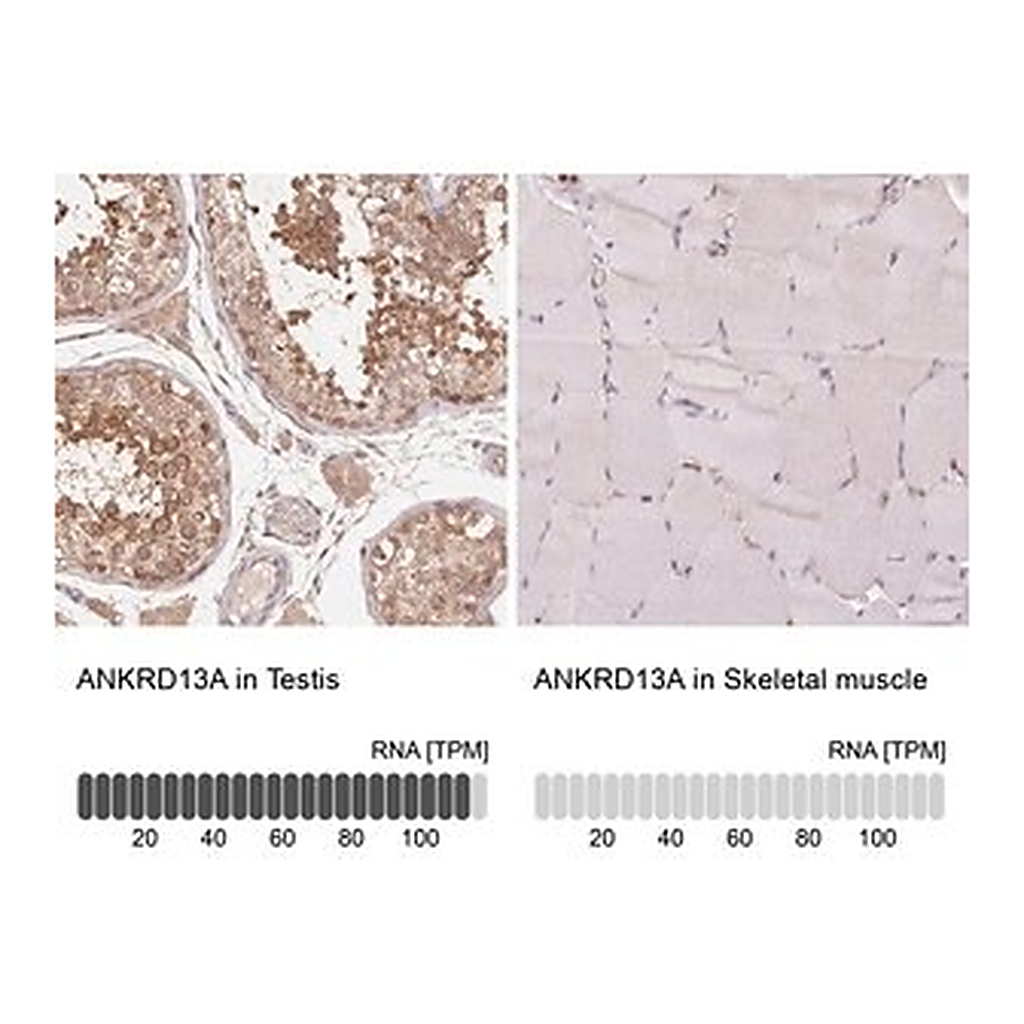 Merck Anti-ANKRD13A antibody produced in rabbit
