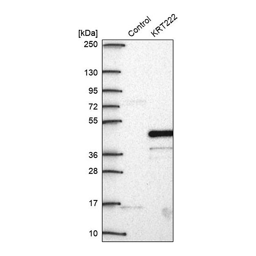 Merck Anti-KRT222 antibody produced in rabbit