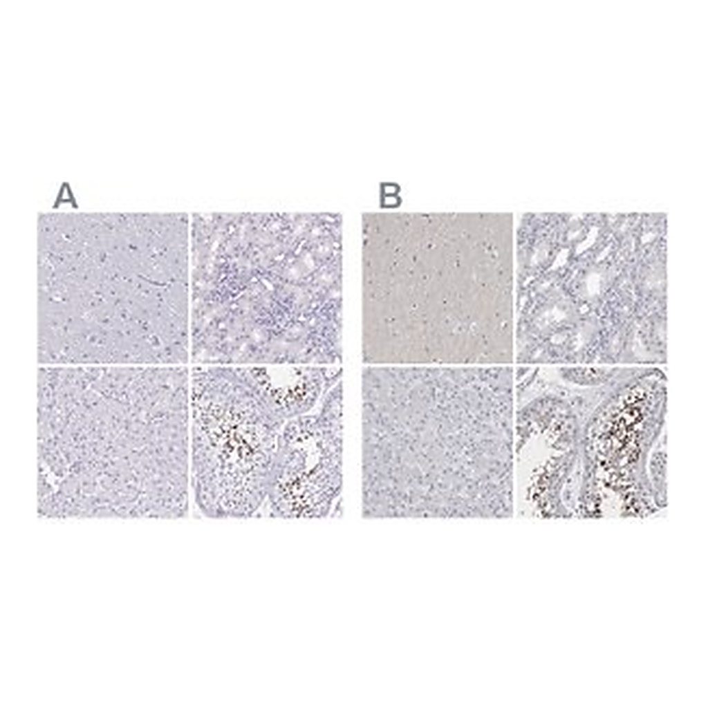 Merck Anti-SPACA1 antibody produced in rabbit