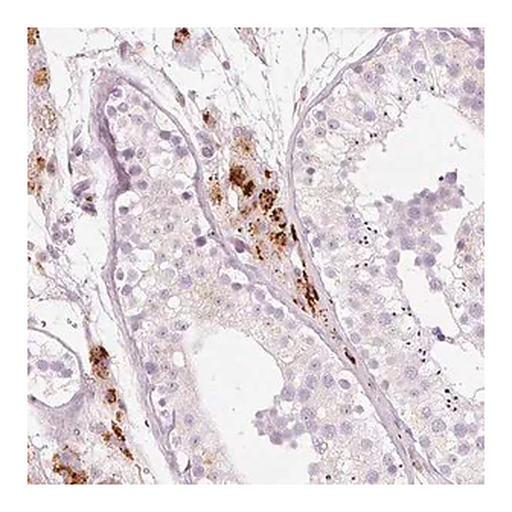 Merck Anti-LECT2 antibody produced in rabbit