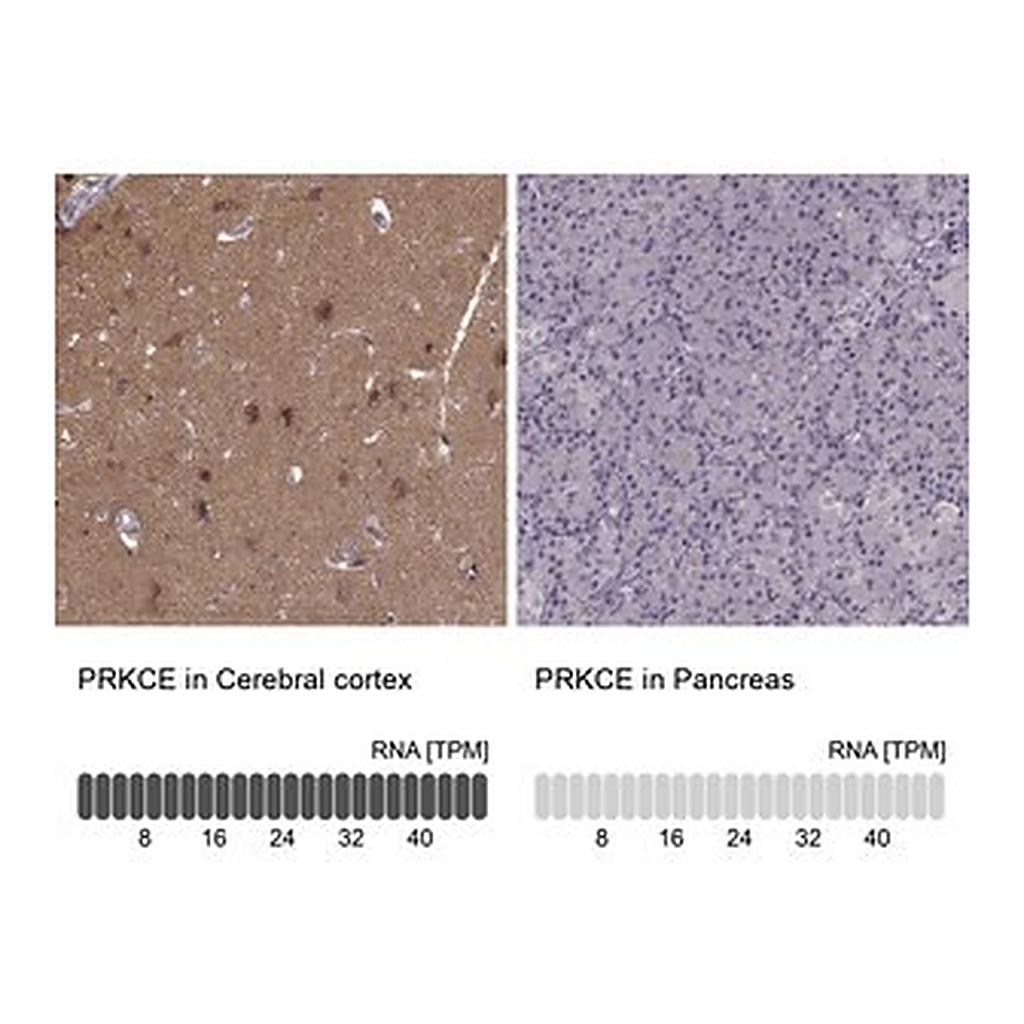 Merck Anti-PRKCE antibody produced in rabbit
