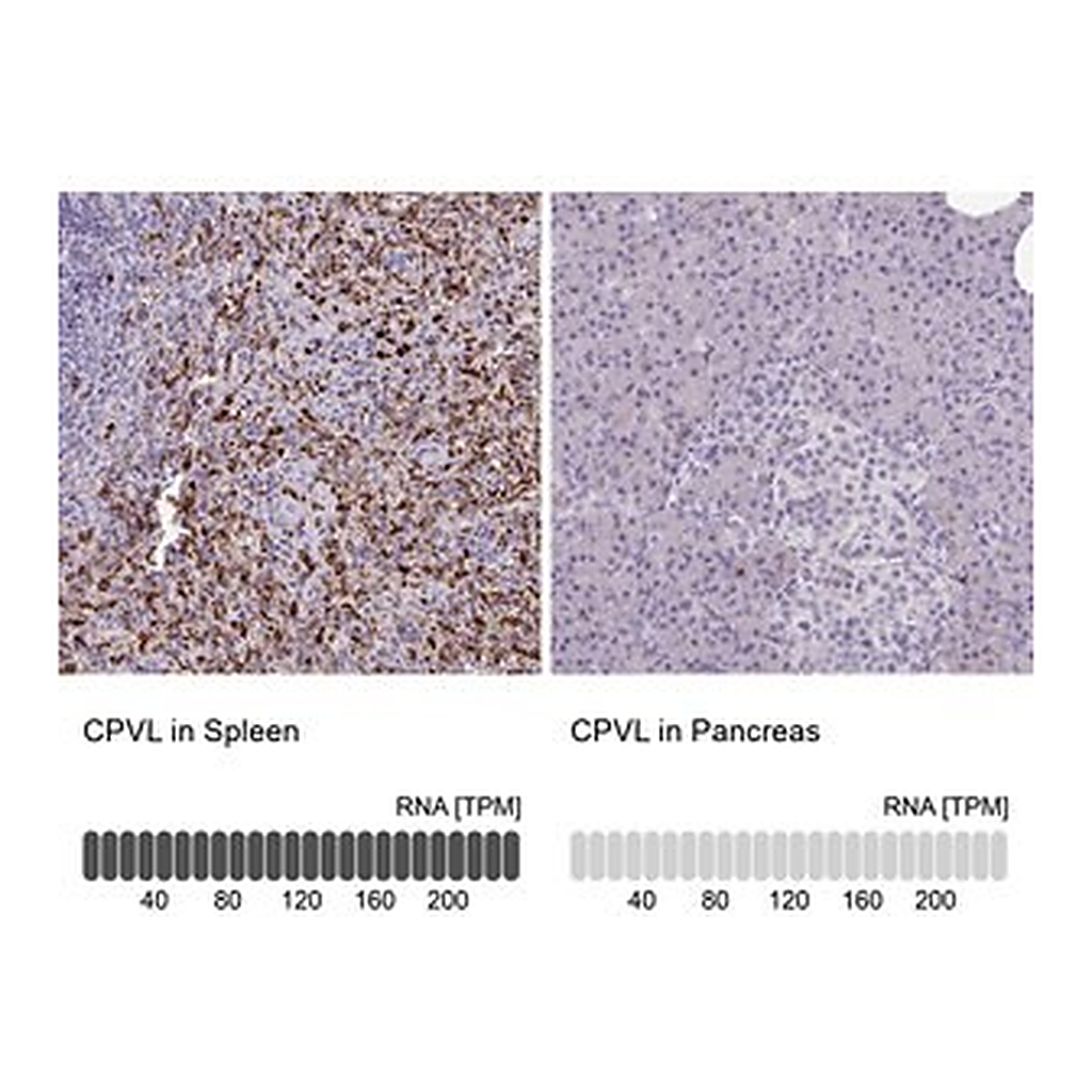 Merck Anti-CPVL antibody produced in rabbit
