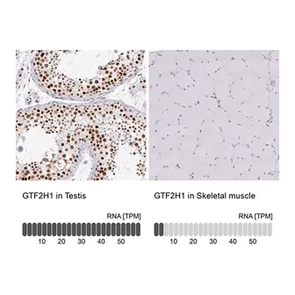 Merck Anti-GTF2H1 antibody produced in rabbit