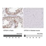 Merck Anti-GTF2H1 antibody produced in rabbit