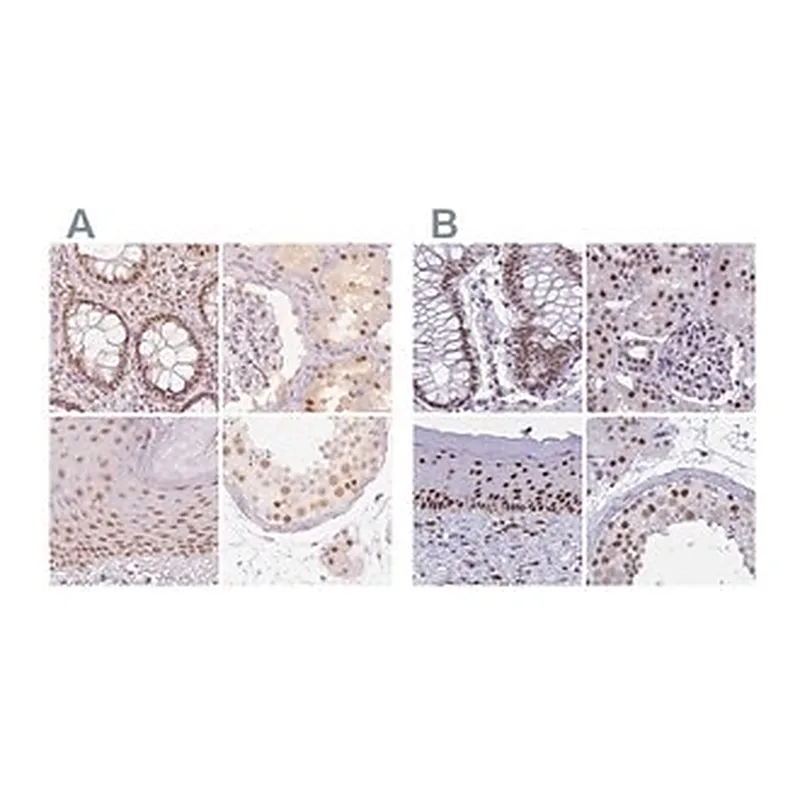 Merck Anti-PPP1R10 antibody produced in rabbit
