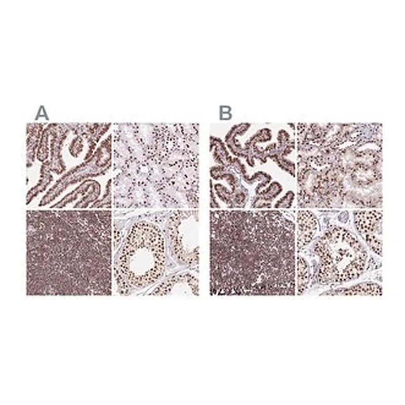 Merck Anti-XRCC6 antibody produced in rabbit