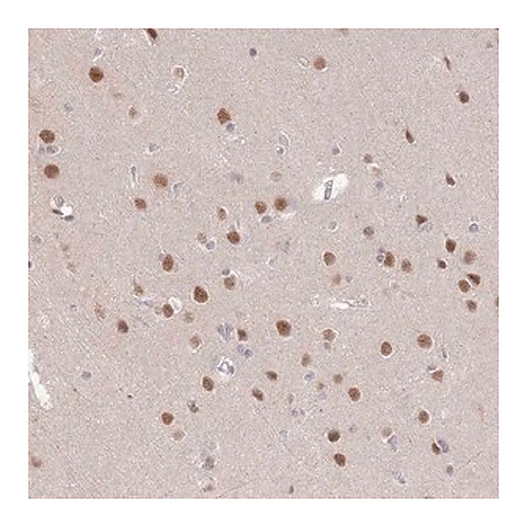 Merck Anti-ZBTB7A antibody produced in rabbit