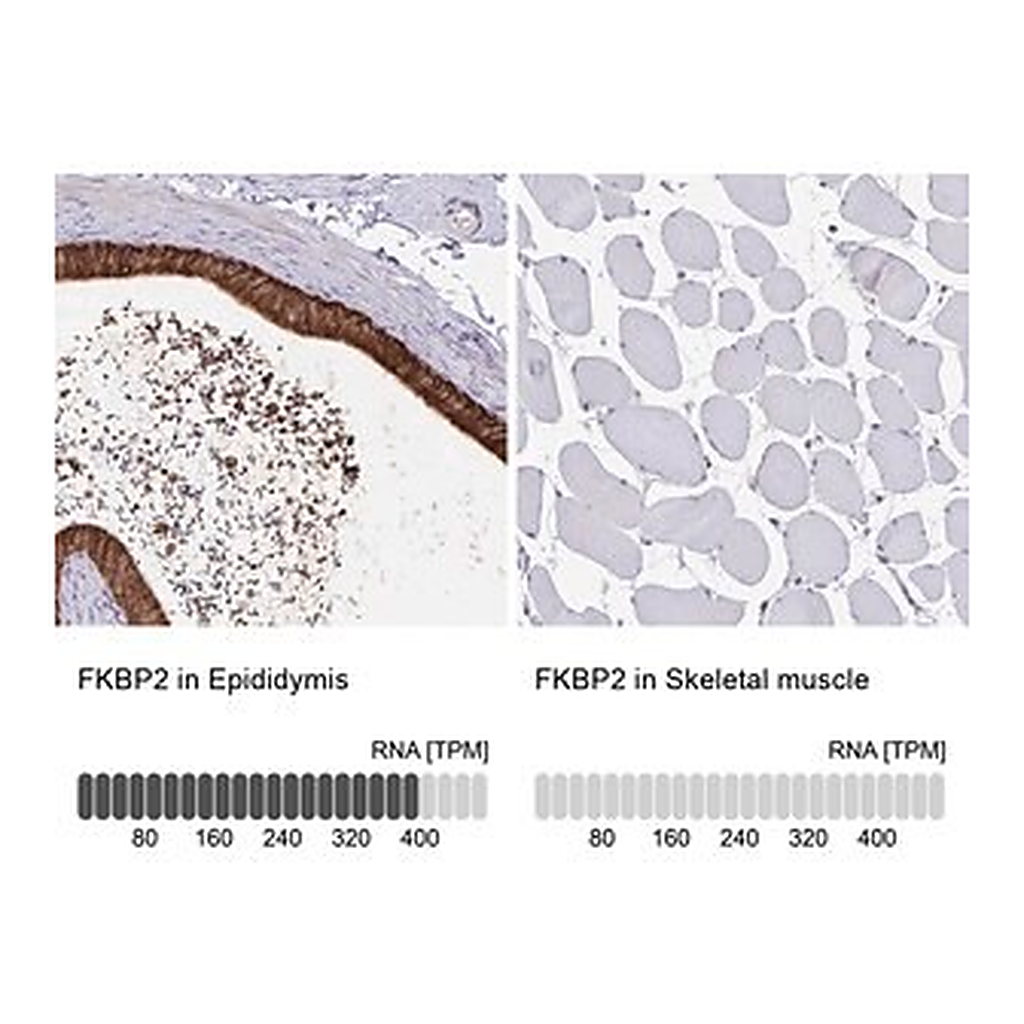 Merck Anti-FKBP2 antibody produced in rabbit