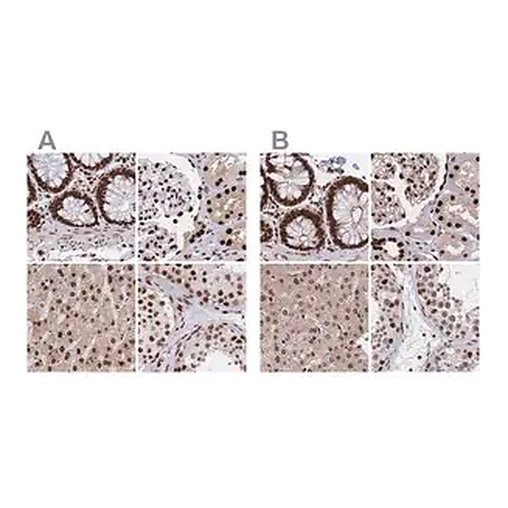 Merck Anti-HDGF antibody produced in rabbit