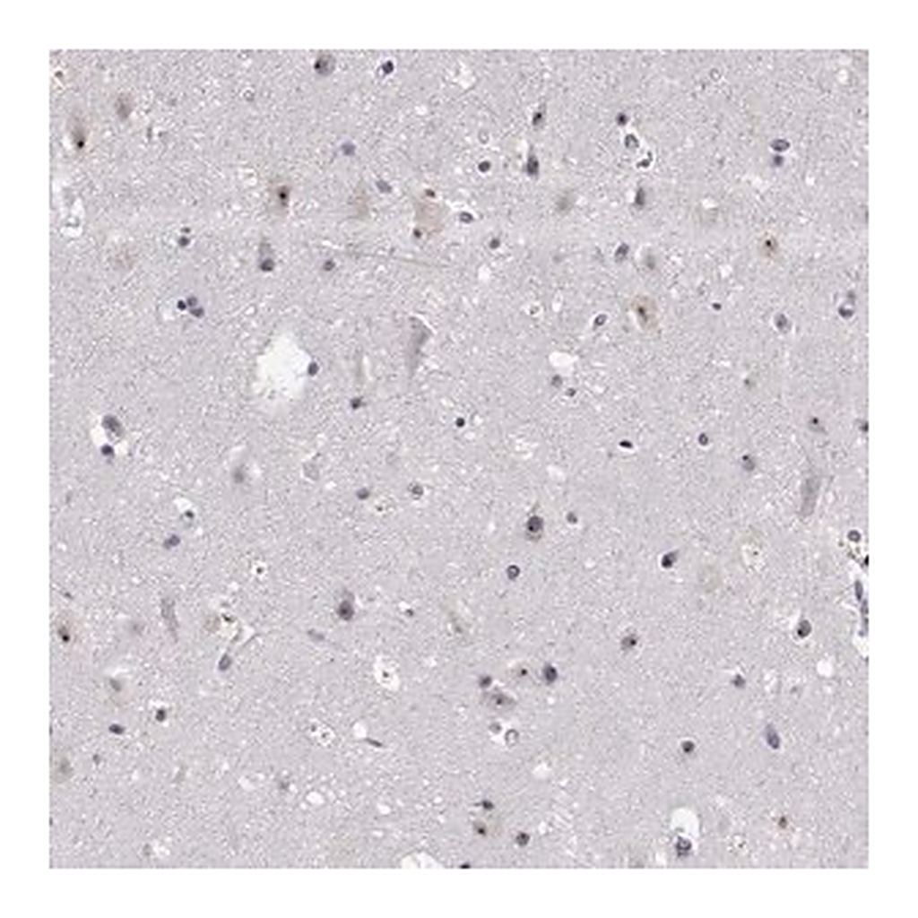 Merck Anti-NHP2 antibody produced in rabbit